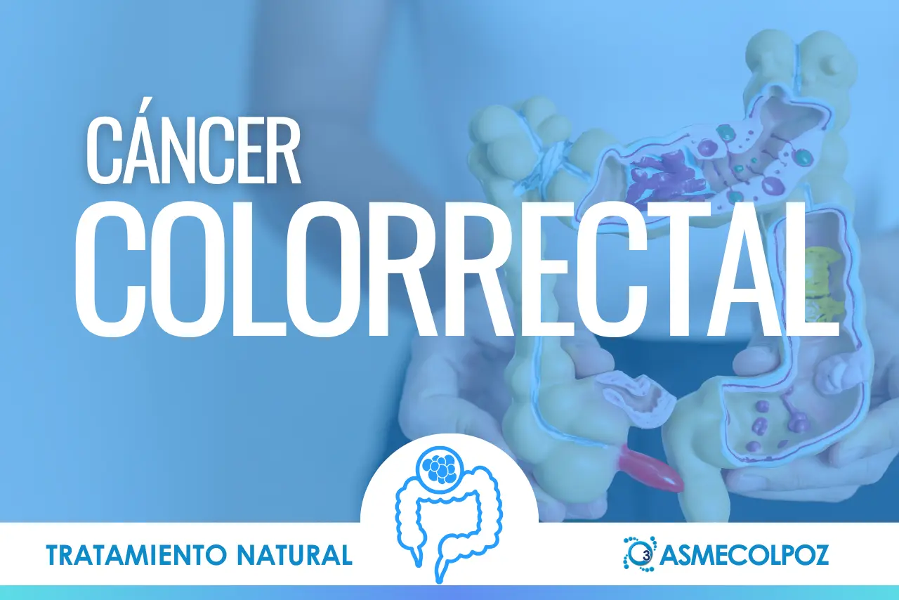 Cáncer Colorrectal