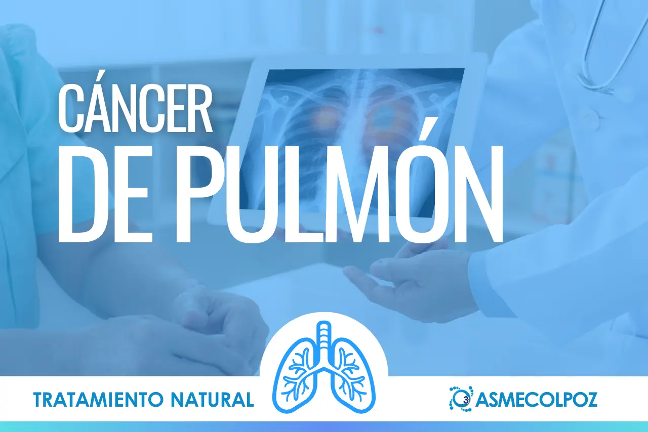 Cáncer de Pulmón