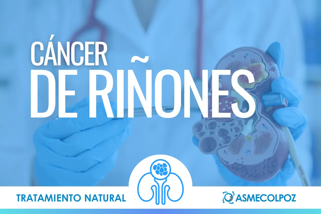 Cáncer de Riñones