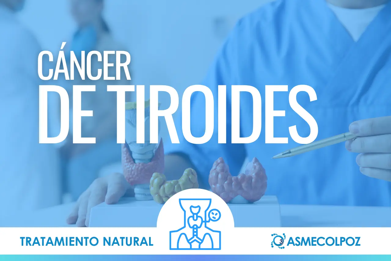 Cáncer de Tiroides