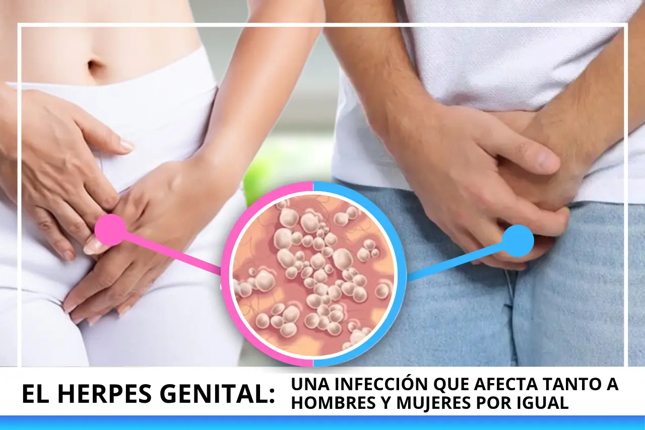 slider 1de 3 tto herpes